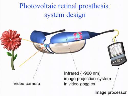 photovoltaic-bionic-eyes