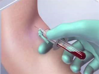 US FDA Cracks Down On Pathway Genomics' Cancer Blood Test