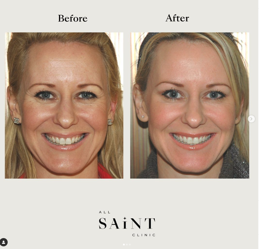 Another happy client of Dr Hkeik