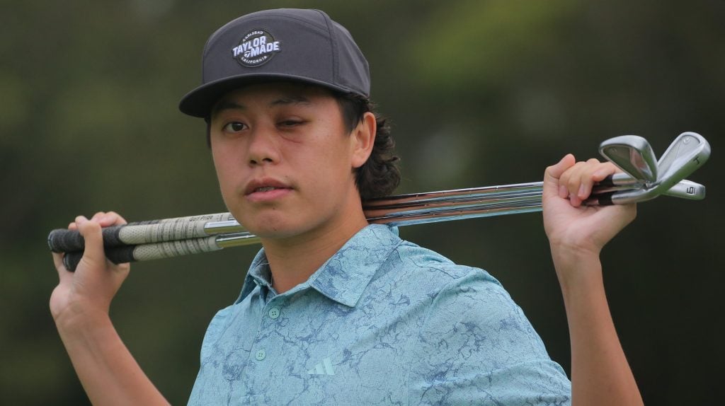 Blinded golf prodigy opens up about freak on-course hit