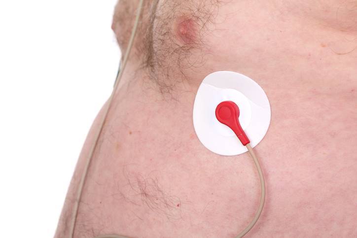 Tech companies target temperature-monitoring patches for COVID-19 - iTnews