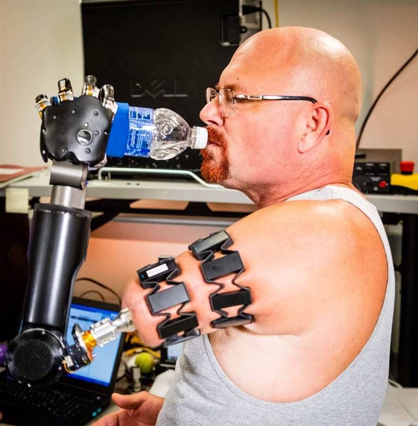 Myo wearable used to control prosthetics