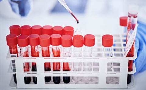 Leaked medical data exposes 1.3 million records