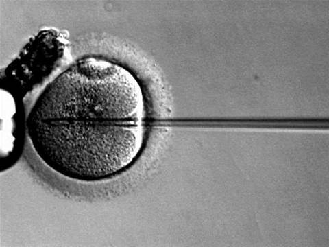 Apple, Facebook pay women to freeze eggs