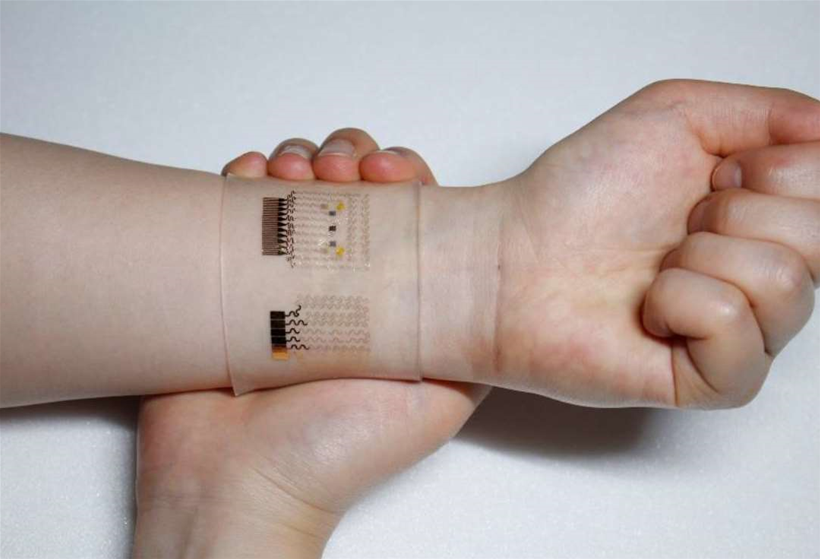 Wearable patch monitors and treats diabetes