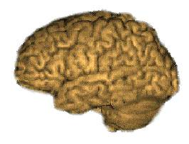 System simulates fault tolerance of the brain