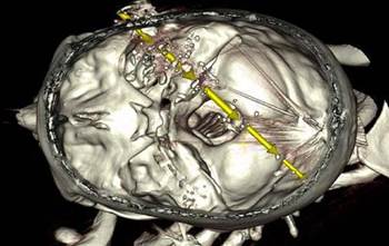 Vic forensics institute taps Monash Uni for ML ballistics