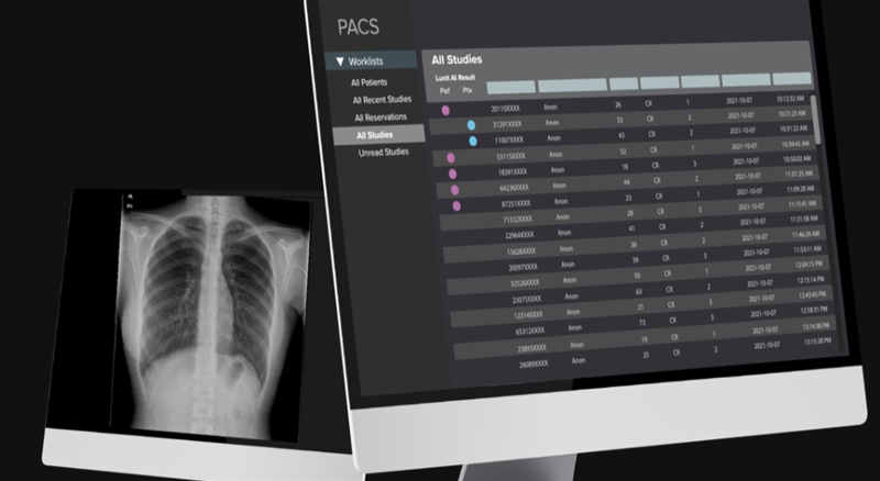 Philippines defense forces to use AI tool for chest screening