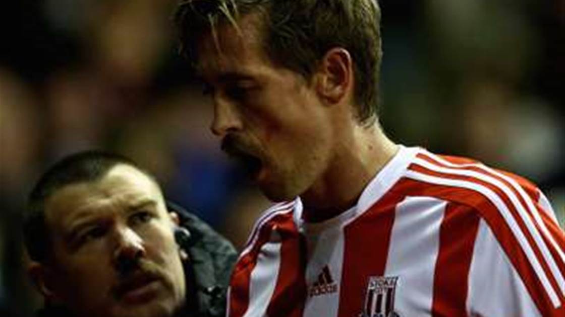 Crouch Loses Teeth In Coloccini Collision Ftbl The Home Of Football In Australia