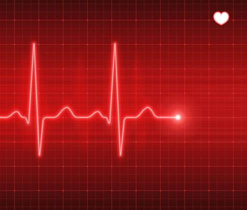 Heartbleed remediation "most behind" in Australia: report