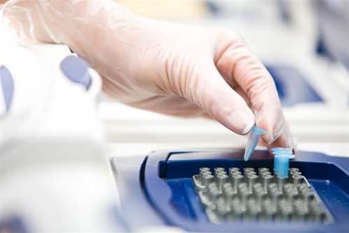 CrimTrac to widen its DNA matching net