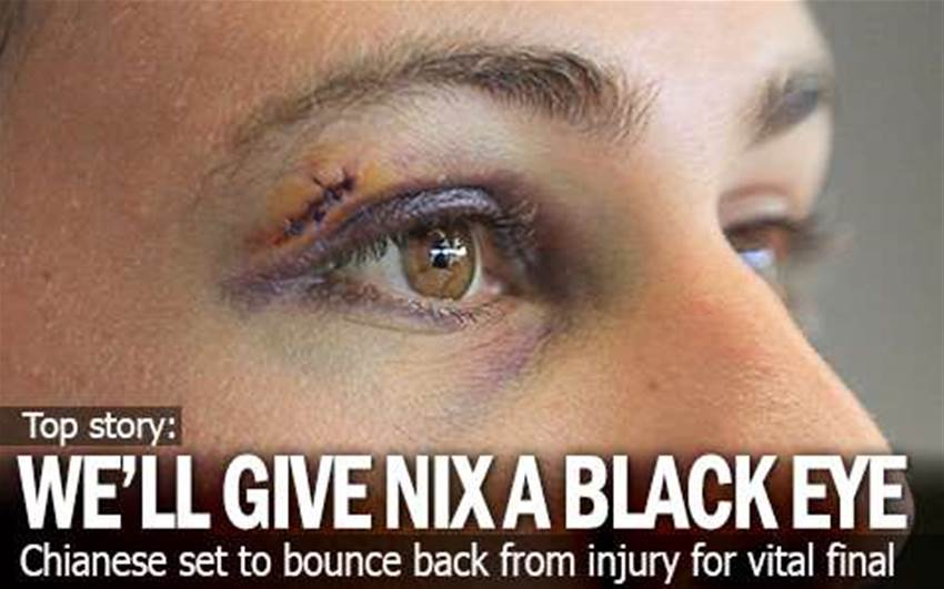 Chianese: We'll Give Nix A Black Eye! Chianese: We'll Give Nix A Black Eye!