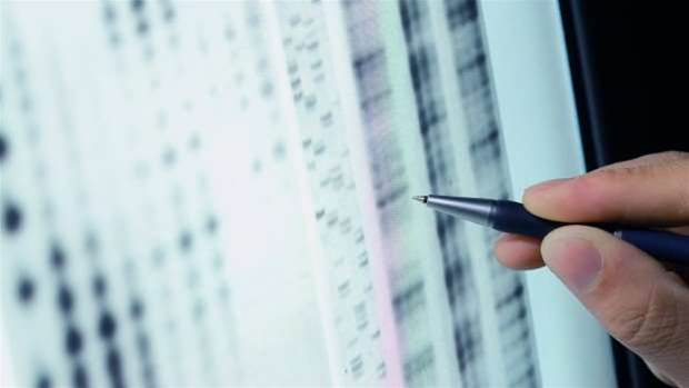 IBM's Watson to tailor Aussie cancer treatments