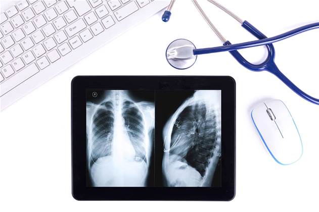 Doctors underwhelmed by NBN for e-health