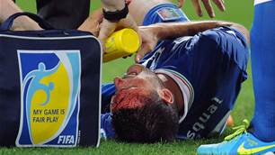 Pasqual may opt for protective headgear