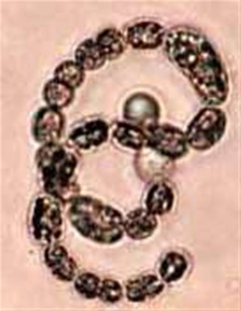 Virus targets Delphi code compiler