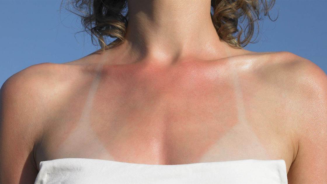 The 5 Types of Skin Cancer You Need to Know How to Recognise