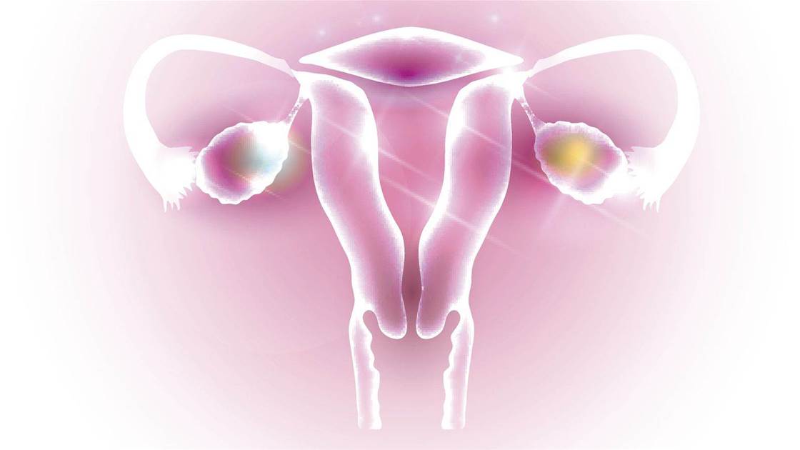 7 Signs of Polycystic Ovary Syndrome&#8212;And What To Do About It
