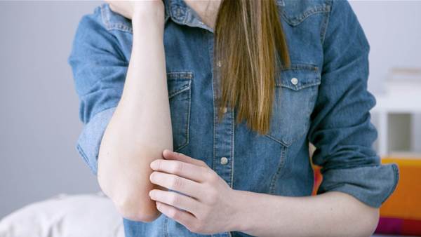 The 5 Types of Psoriasis