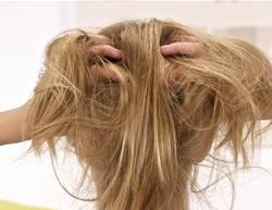 5 Proven Scalp Psoriasis Treatments Dermatologists Swear By