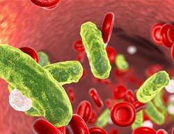 What Is Sepsis? This Life-Threatening Condition Is on the Rise