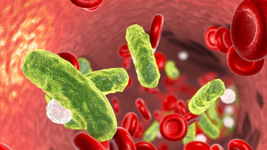 What Is Sepsis? This Life-Threatening Condition Is on the Rise