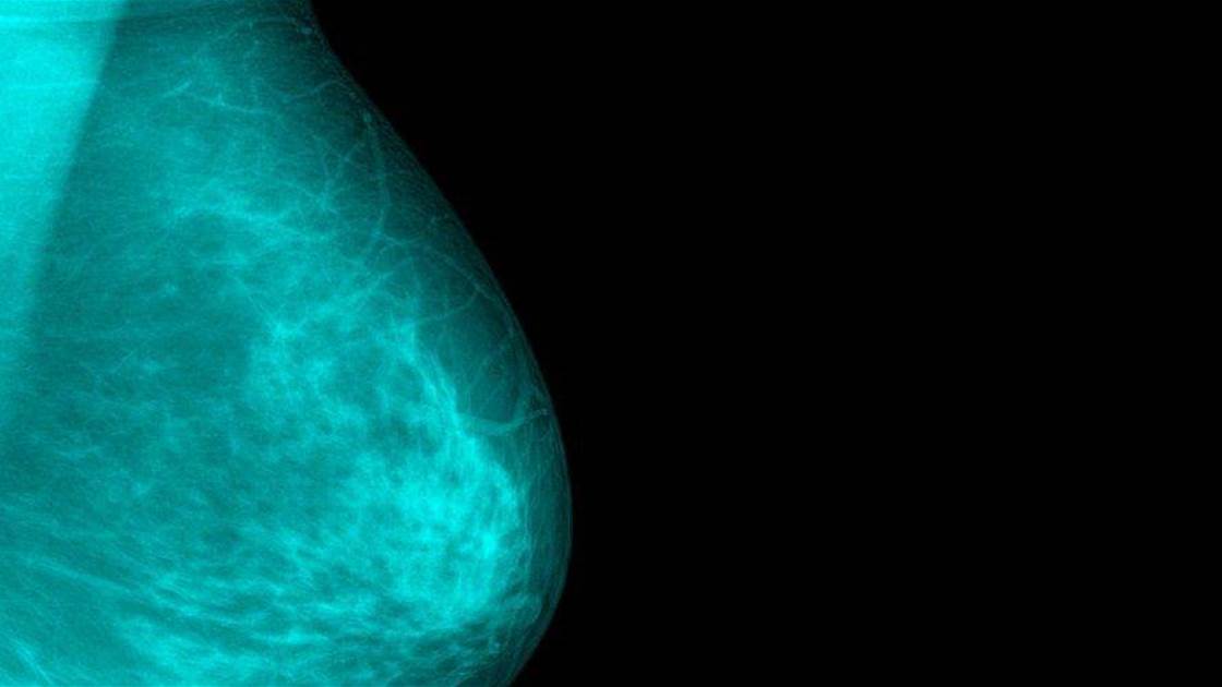 4 Breast Cancer Symptoms That Have Nothing to Do With Feeling a Lump