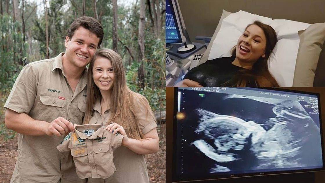 does bindi irwin have mosaic down syndrome