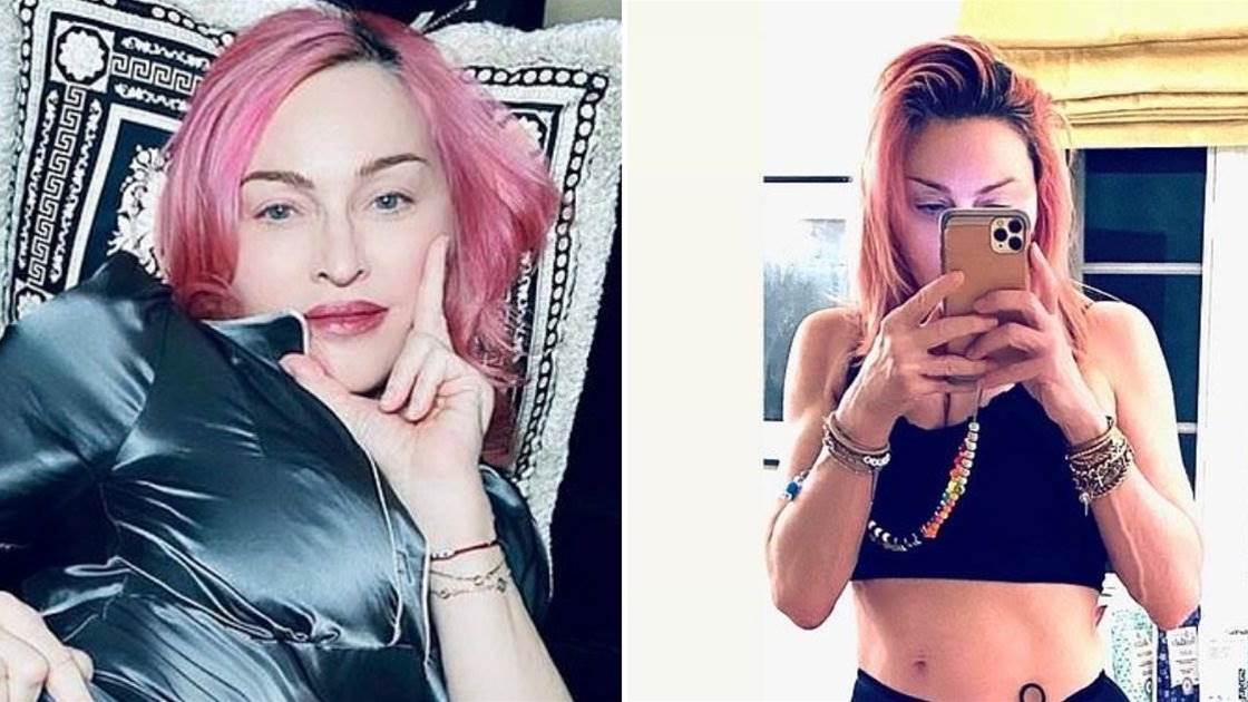 Madonna reveals her “beautiful scar” - Health - Prevention Australia