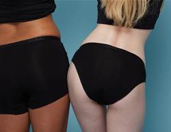 The Right Way To Do Pelvic Floor Exercises