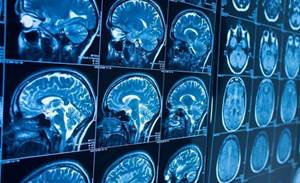 Sydney Uni's Brain and Mind Centre scores $7m for AI projects