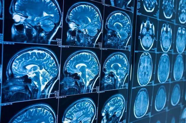 To err is human, so brain scans augmented by AI get $2.4m