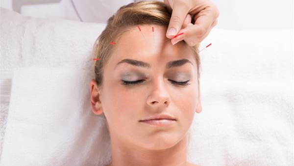 Can acupuncture reduce wrinkles?