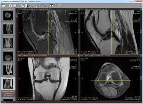 Millions of Australians' sensitive medical images, data left openly accessible