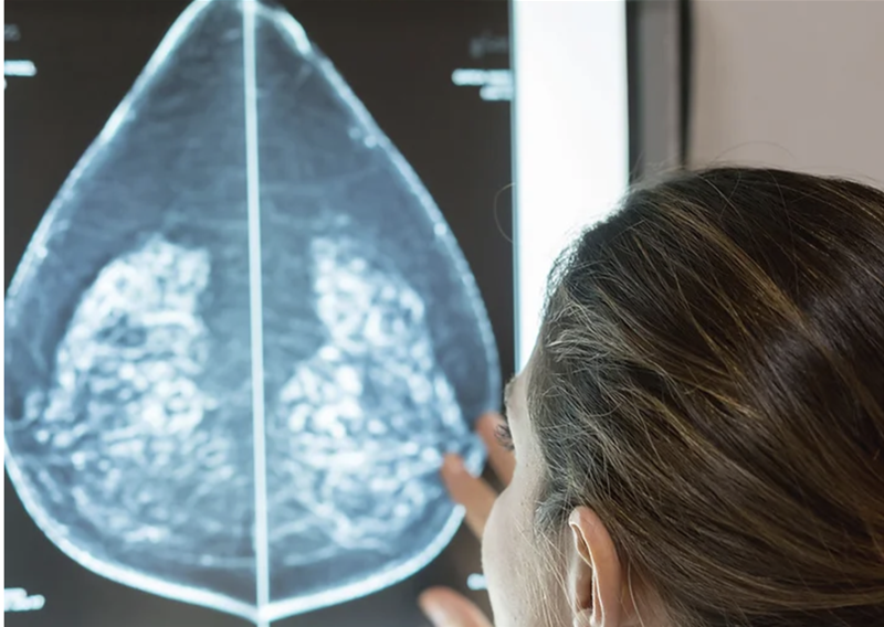 Singapore startup FathomX builds AI based tool to diagnose breast cancer