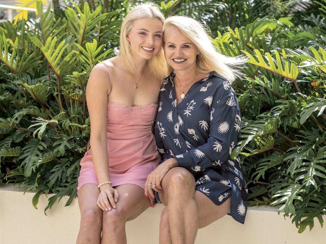 frankie throwback – a chinwag with paralympian alexa leary frankie throwback – a chinwag with paralympian alexa leary