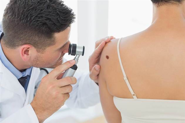 AI beats doctors at skin cancer diagnosis