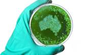Australia to get an AI-powered map of drug-resistant germs