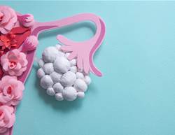 The PCOS Name Change Every Woman Should Know About