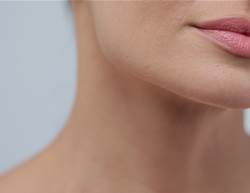 How to Get Rid of Chin Acne, According to Dermatologists