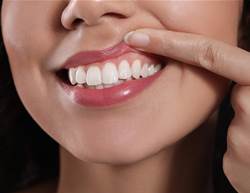 Dry Mouth, Sore Gums, Burning Tongue? It Could Be Menopause