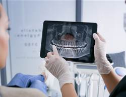 Could Mouth Bacteria Increase Heart Attack Risk?