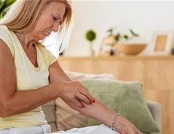 8 Skin Clues to Diabetes