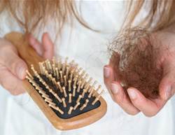 How Much Hair Loss Is Actually Normal—and When to Be Concerned