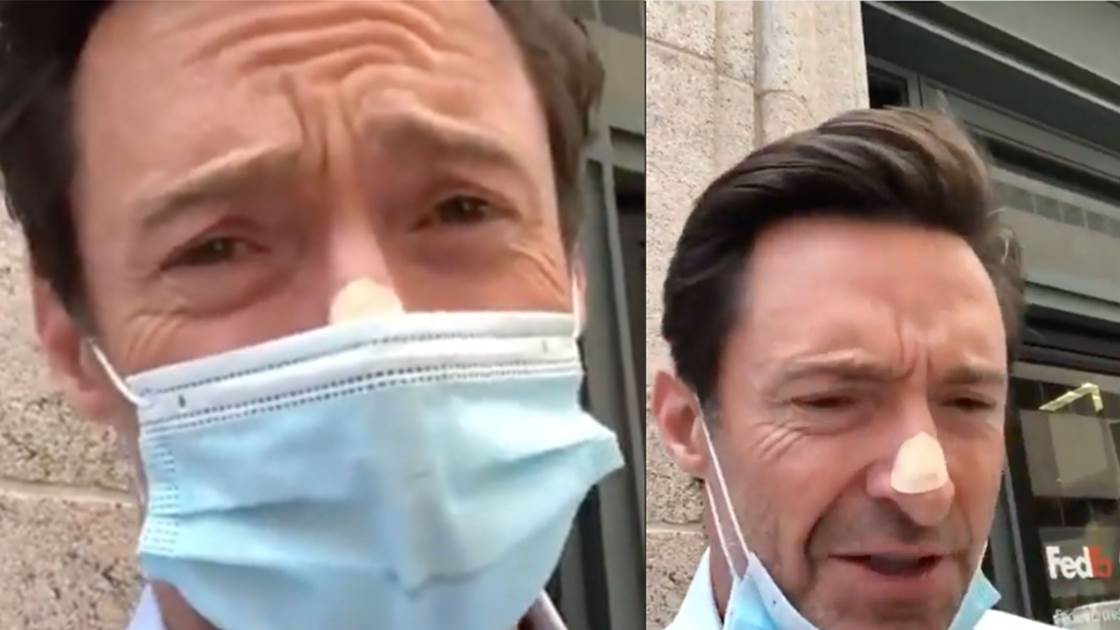 After Biopsy on Nose, Hugh Jackman Urges Fans to Get Checked Regularly for Skin Cancer
