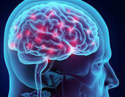 Excess Belly Fat Might Actually Make Your Brain Shrink, Study Suggests