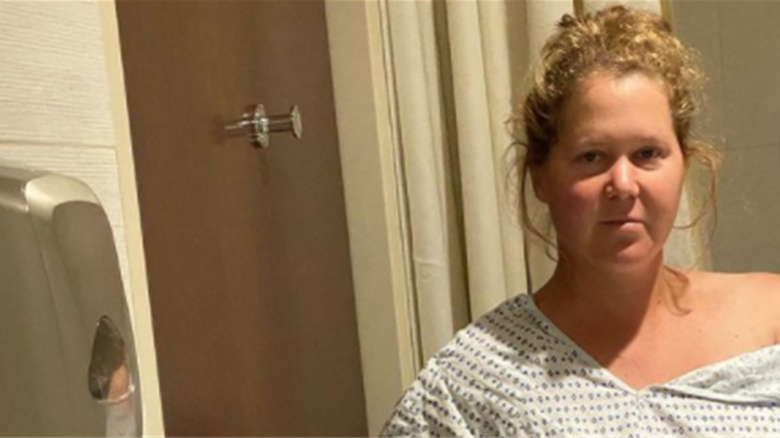 Amy Schumer Reveals She Had a Hysterectomy in an Effort to Combat Endometriosis