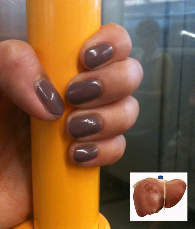 Claire explains how to fix gross nails